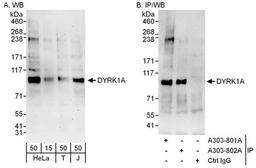 Detection of human DYRK1A by WB and IP.