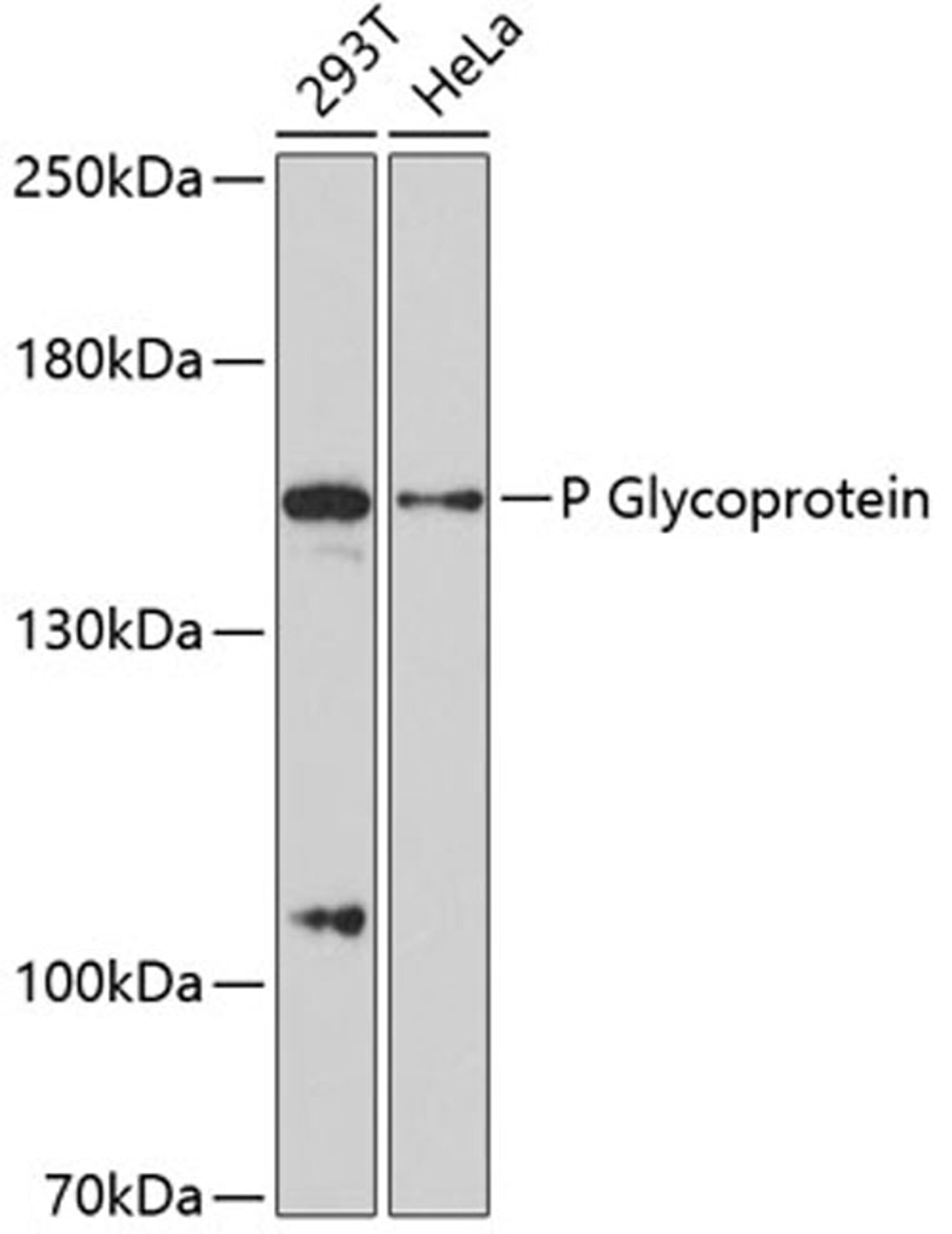 Western blot - P Glycoprotein antibody (A11747)