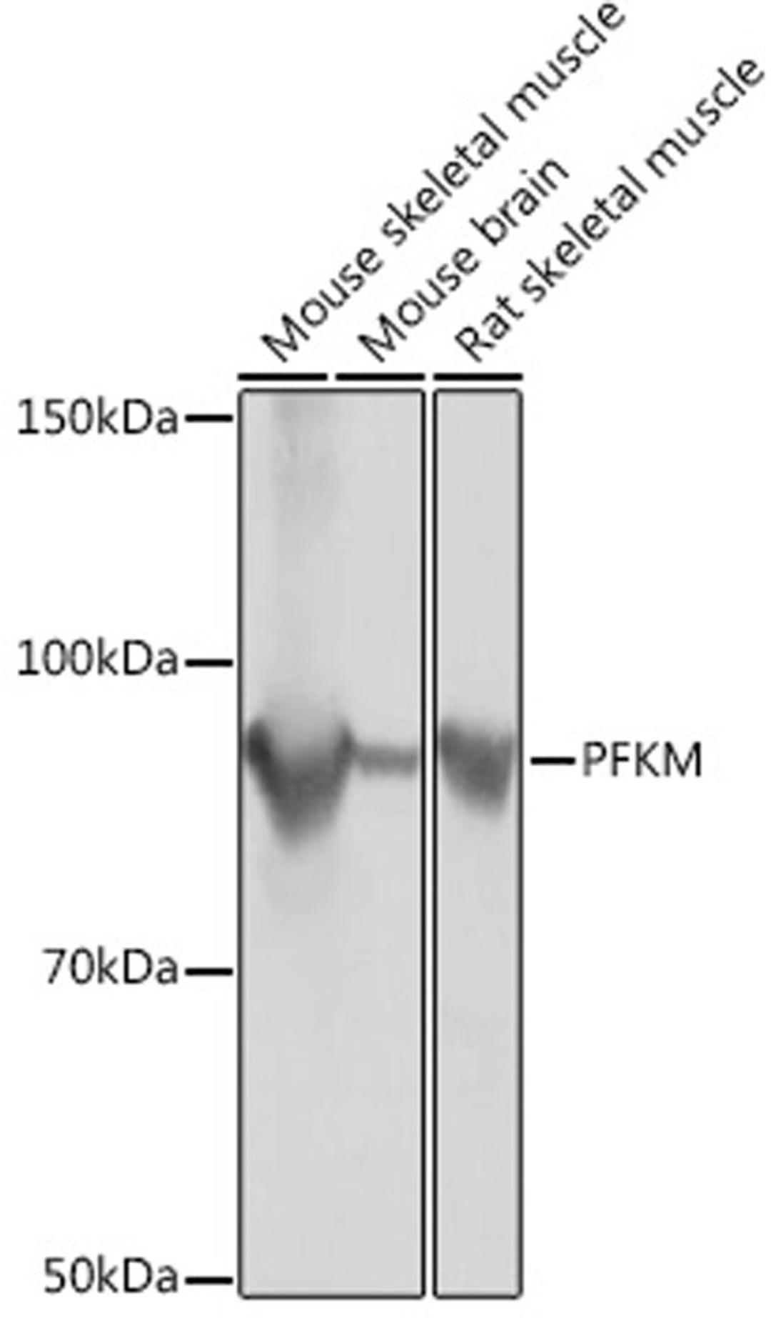 Western blot - PFKM Rabbit mAb (A3671)