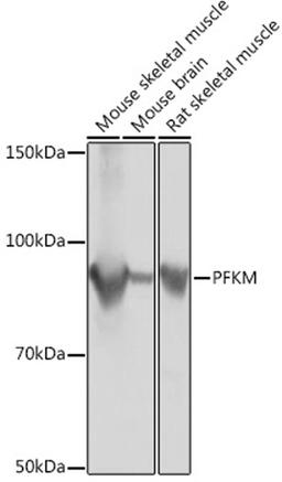 Western blot - PFKM Rabbit mAb (A3671)