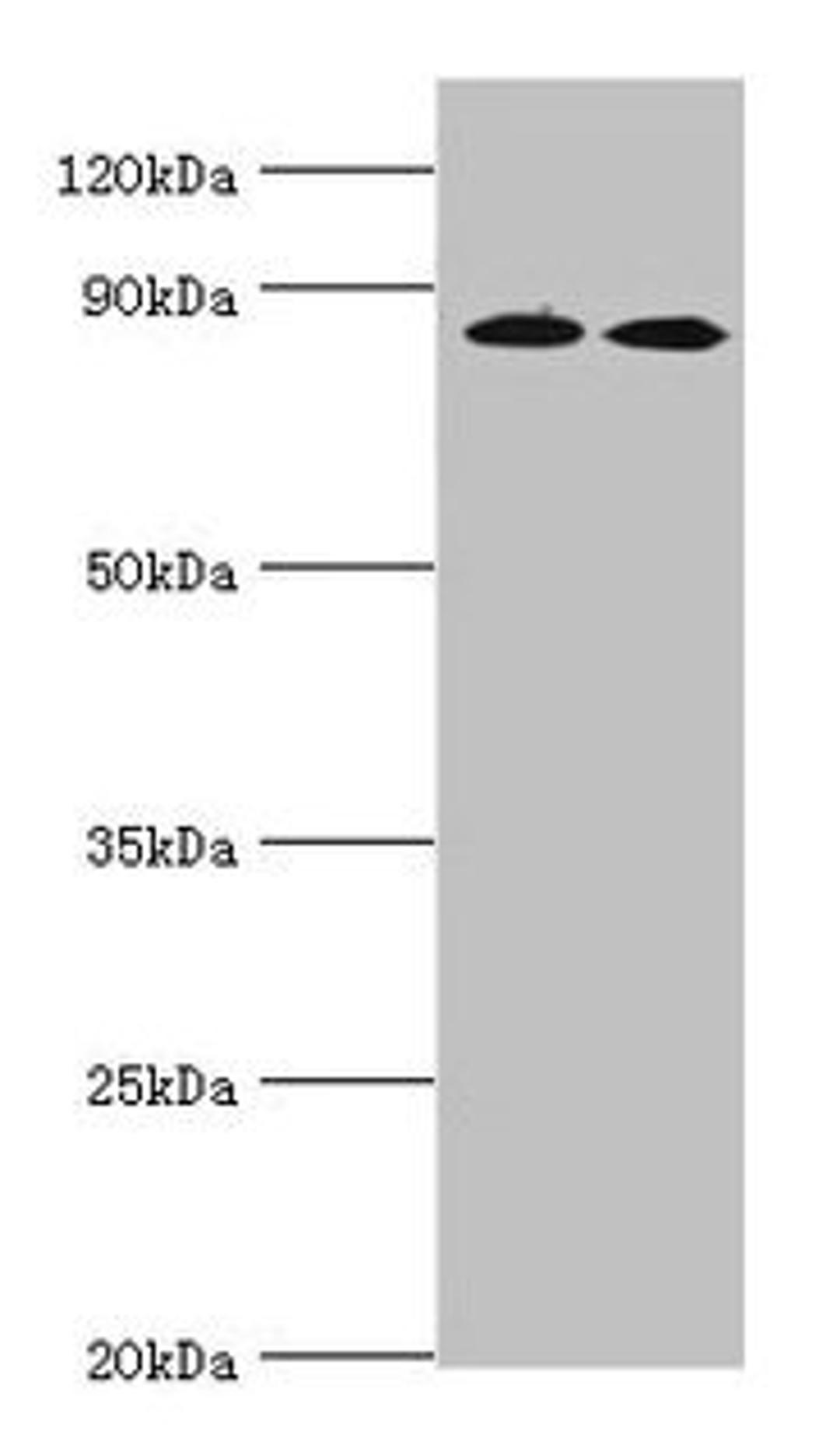 Western blot. All lanes: AMP deaminase 3 antibody at 2ug/ml. Lane 1: NIH/3T3 whole cell lysate. Lane 2: 293T whole cell lysate. Lane 3: Mouse lung tissue. Secondary. Goat polyclonal to rabbit IgG at 1/10000 dilution. Predicted band size: 89, 25, 77, 90, 72 kDa. Observed band size: 89 kDa. 