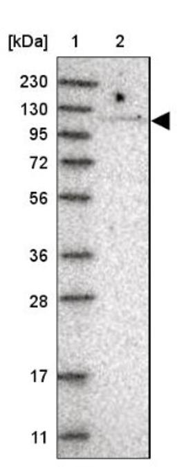 Western Blot: TBC1D2 Antibody [NBP1-87335] - Lane 1: Marker [kDa] 230, 130, 95, 72, 56, 36, 28, 17, 11<br/>Lane 2: Human cell line RT-4