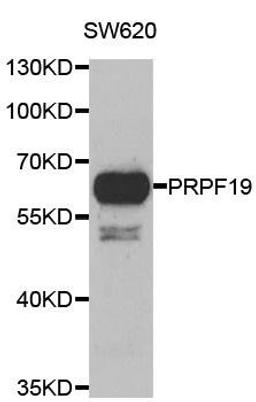 Western blot analysis of extracts of SW620 cell line using PRPF19 antibody