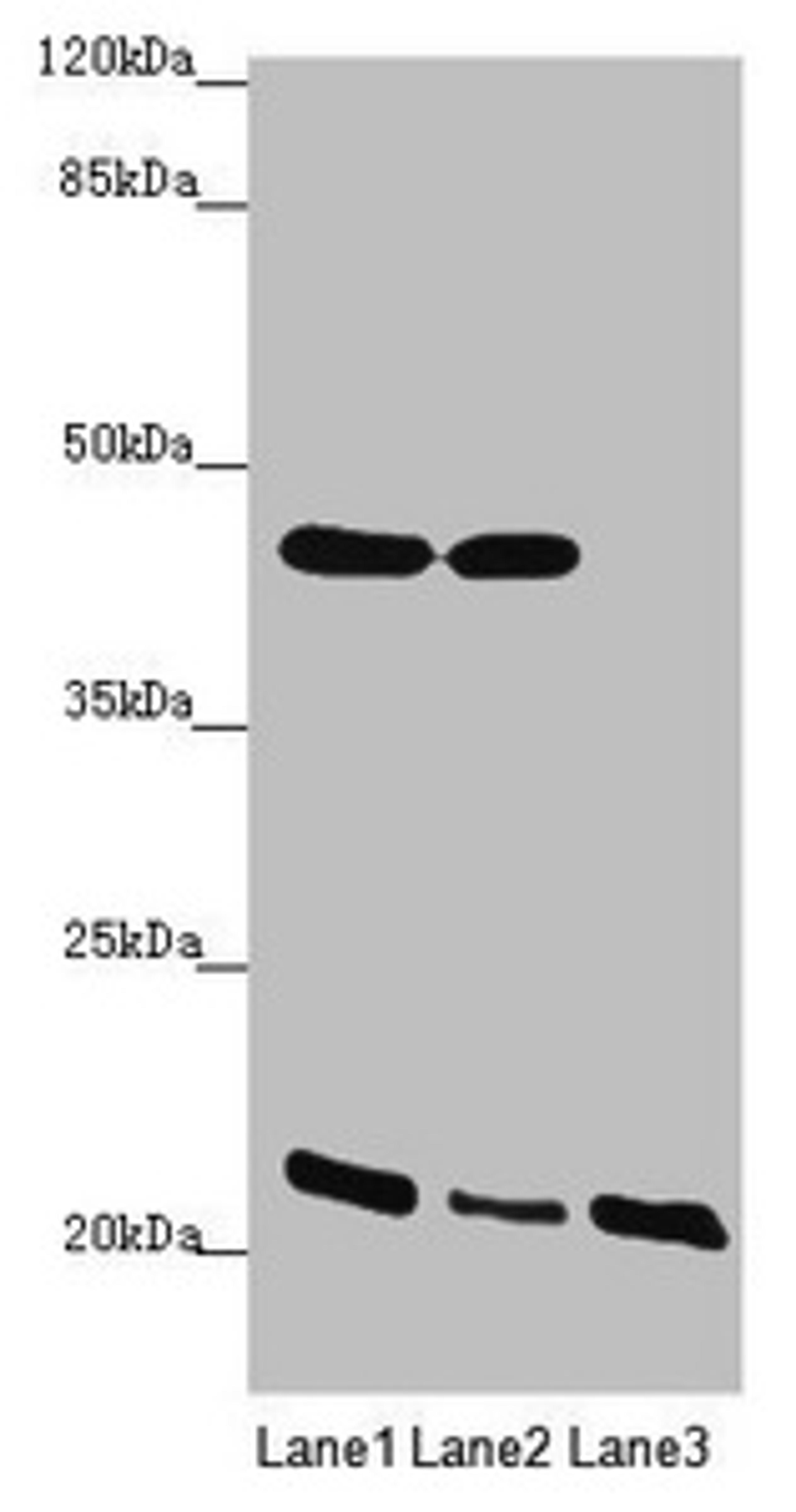 Western blot. All lanes: ZDHHC16 antibody at 1.91 ug/ml. Lane 1: MCF-7 whole cell lysate. Lane 2: HepG2 whole cell lysate. Lane 3: A375 whole cell lysate. Secondary. Goat polyclonal to rabbit IgG at 1/10000 dilution. Predicted band size: 44, 42, 39, 35 kDa. Observed band size: 44, 22 kDa.