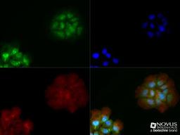 Immunocytochemistry/Immunofluorescence: LPAR1/LPA1/EDG-2 Antibody [NBP1-03363] - A431 cells were fixed for 10 minutes using 10% formalin and then permeabilized for 5 minutes using 1X TBS + 0.5% Triton-X100. The cells were incubated with anti-EDG2/LPAR1/LPA1 (NBP1-03363) at a 1:100 dilution overnight at 4C and detected with an anti-rabbit Dylight 488 (Green) at a 1:500 dilution. Alpha tubulin was used as a co-stain at a 1:1000 dilution and detected with and anti-mouse Dylight 550 (Red) at a 1:500 dilution. Nuclei were counterstained with DAPI (Blue). Cells were imaged using a 40X objective.