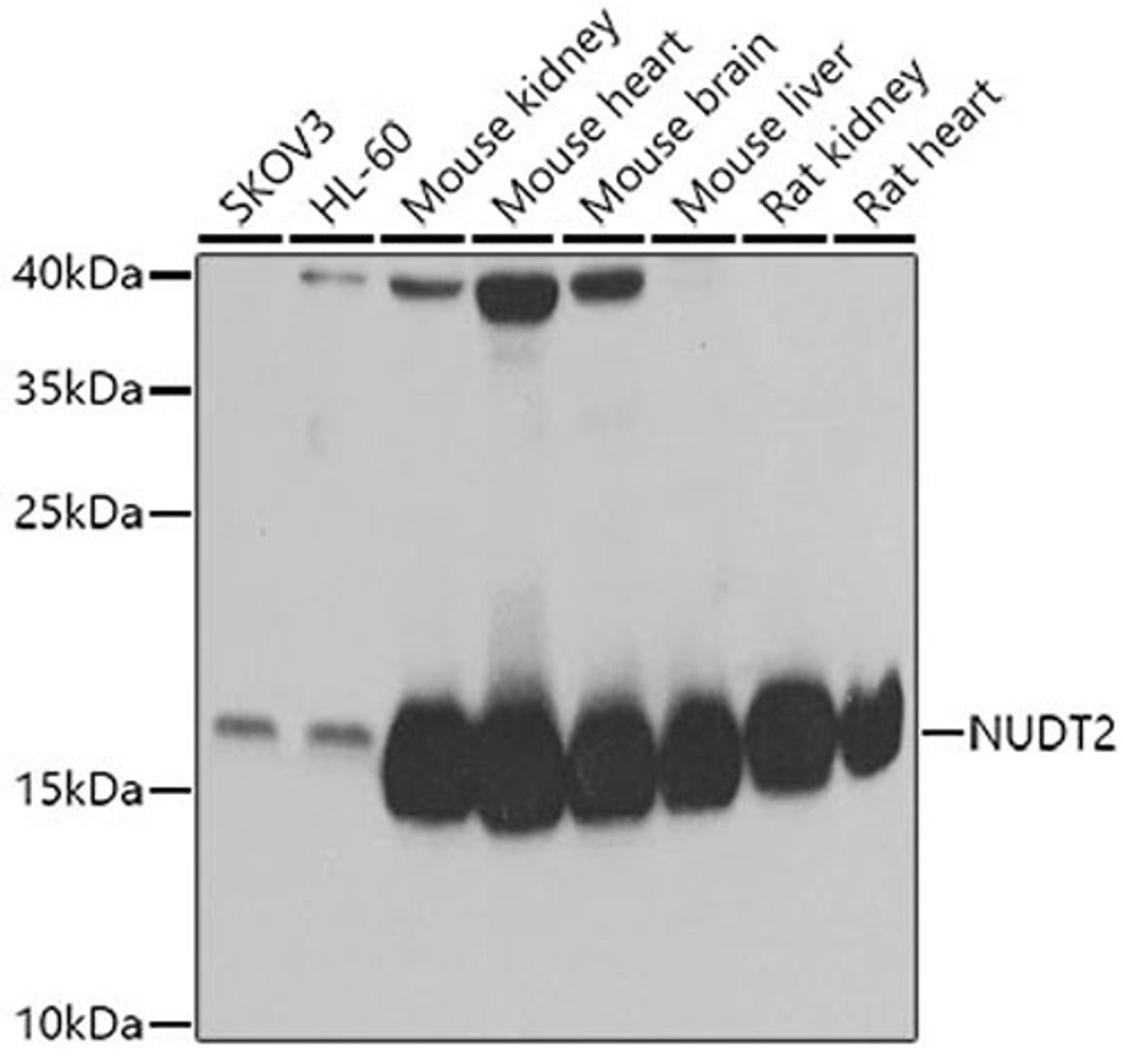 Western blot - NUDT2 antibody (A6868)