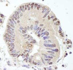 Detection of human USP10 by immunohistochemistry.