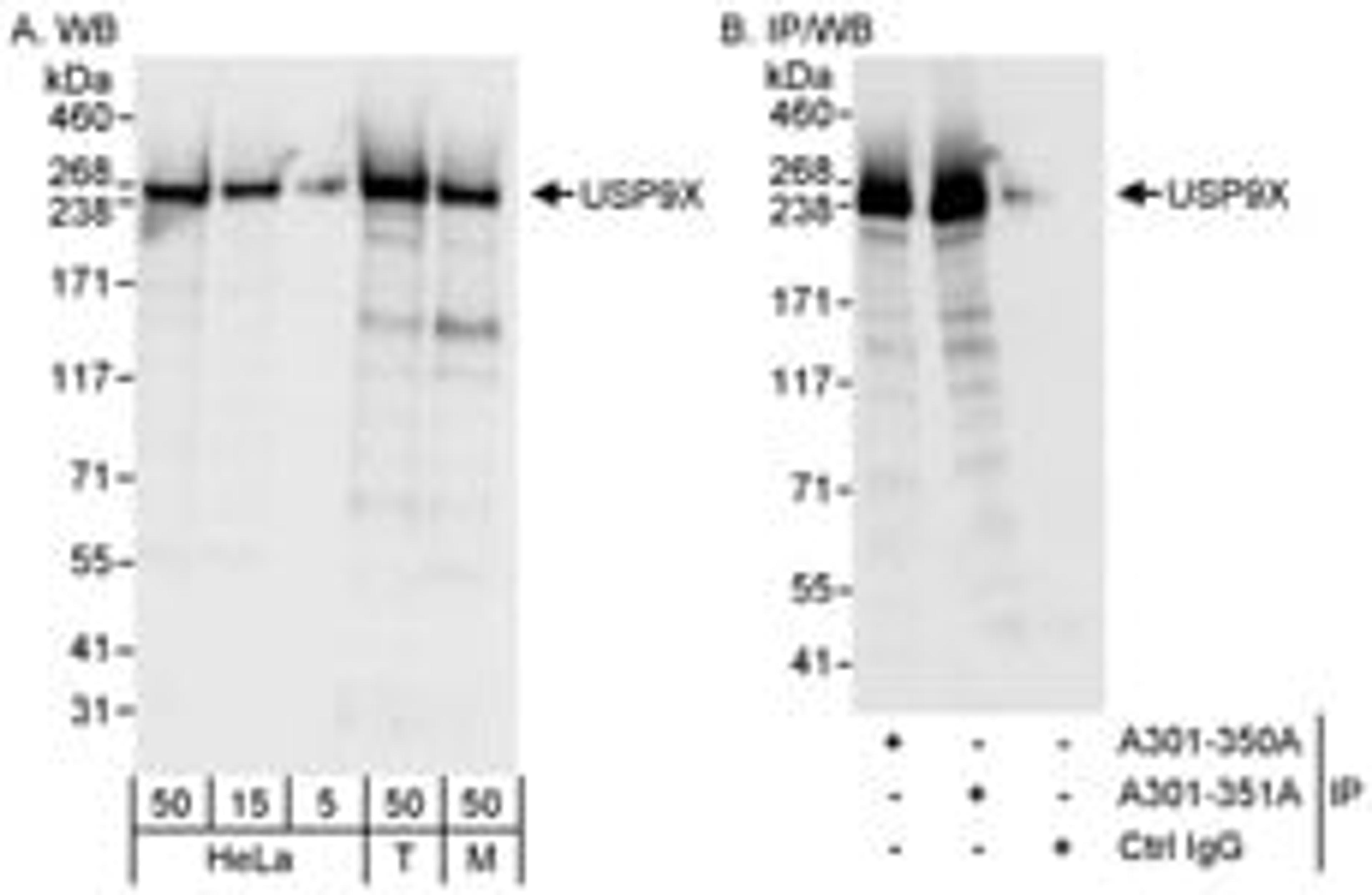 Detection of human and mouse USP9X by western blot (h&m) and immunoprecipitation (h).