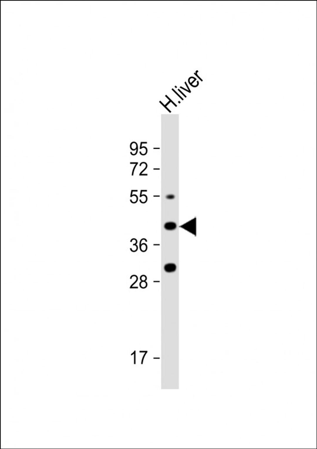 Western Blot at 1:1000 dilution + human liver lysate Lysates/proteins at 20 ug per lane.