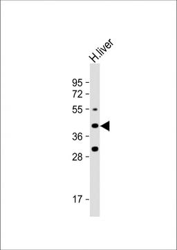 Western Blot at 1:1000 dilution + human liver lysate Lysates/proteins at 20 ug per lane.