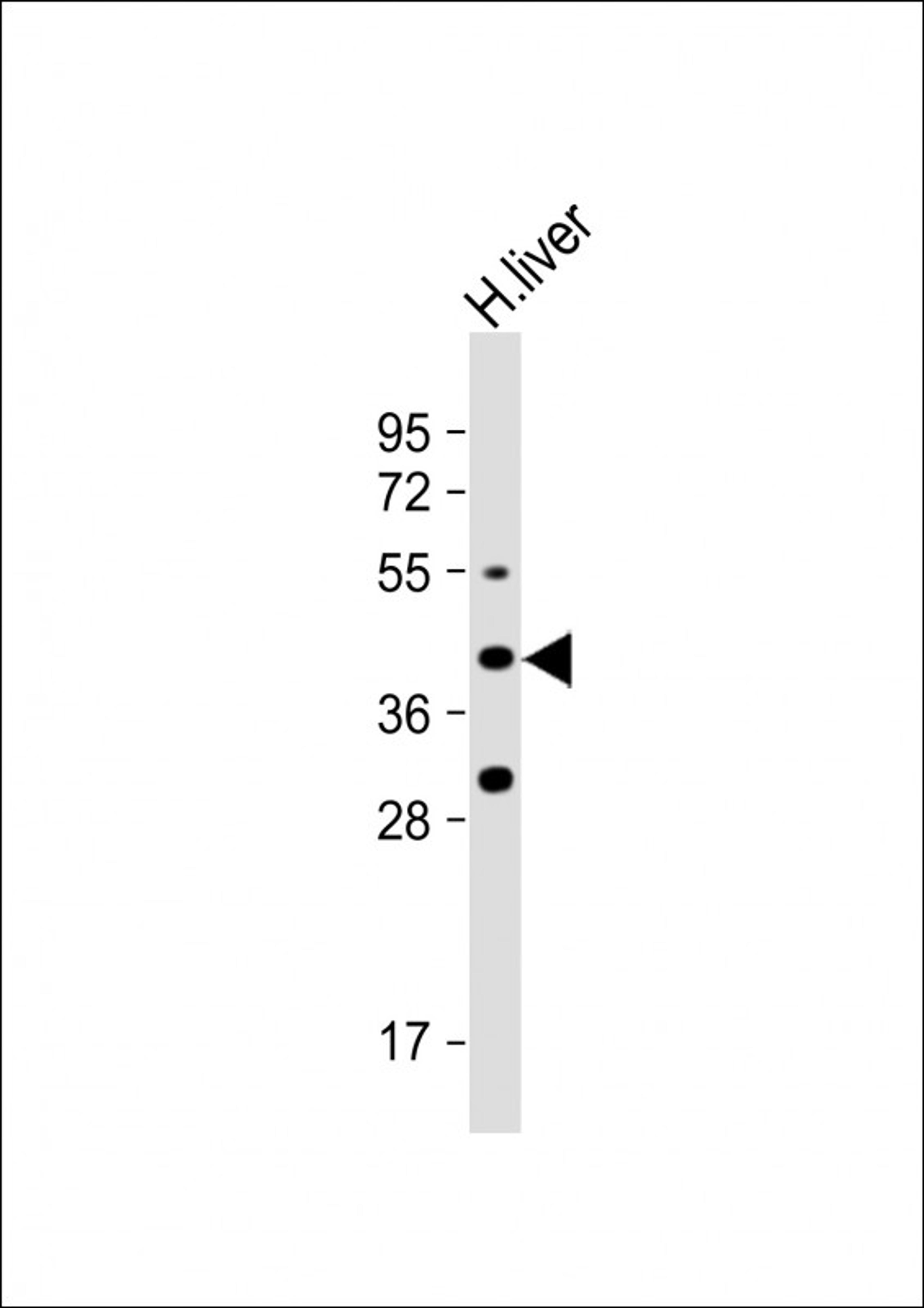 Western Blot at 1:1000 dilution + human liver lysate Lysates/proteins at 20 ug per lane.