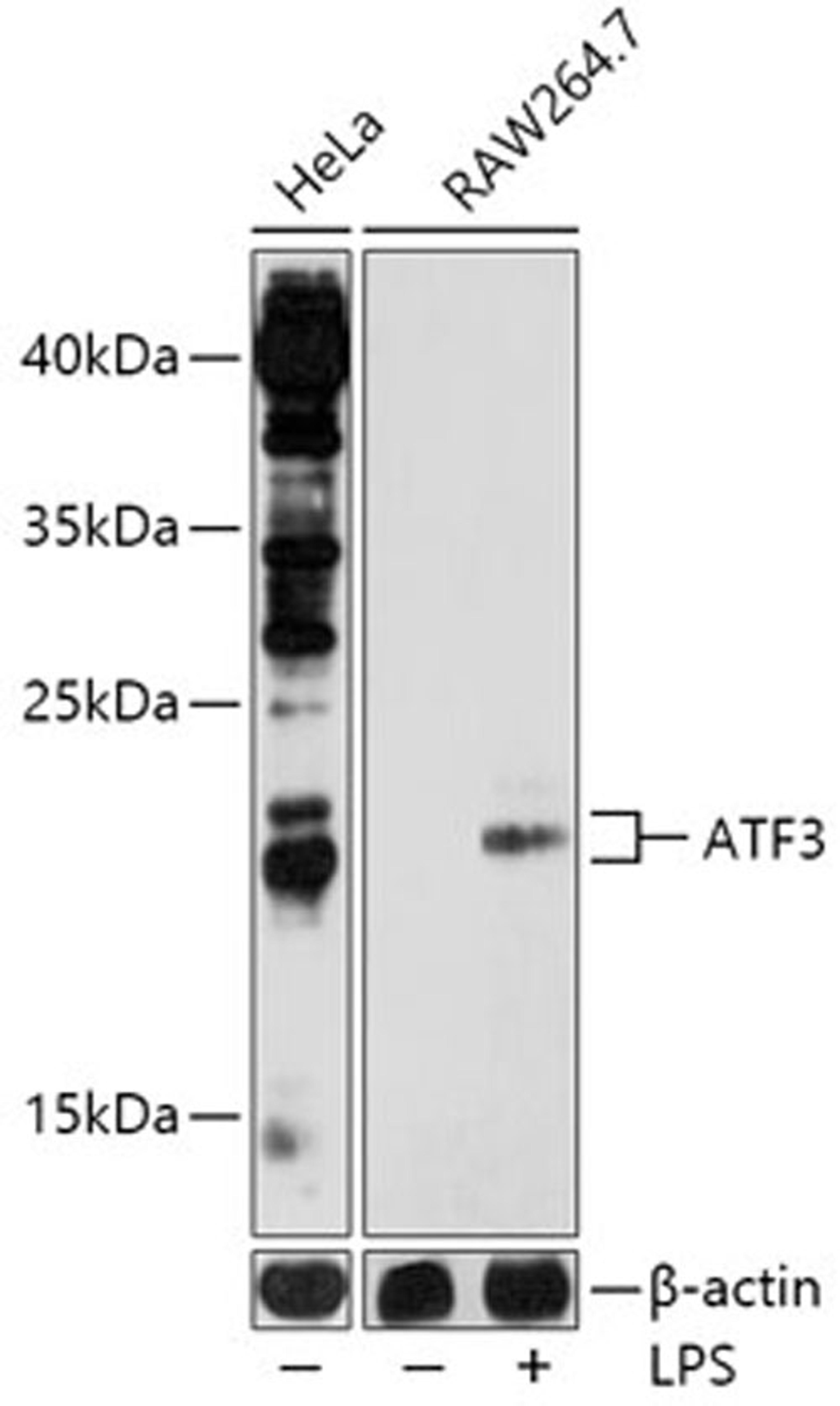 Western blot - ATF3 antibody (A13470)