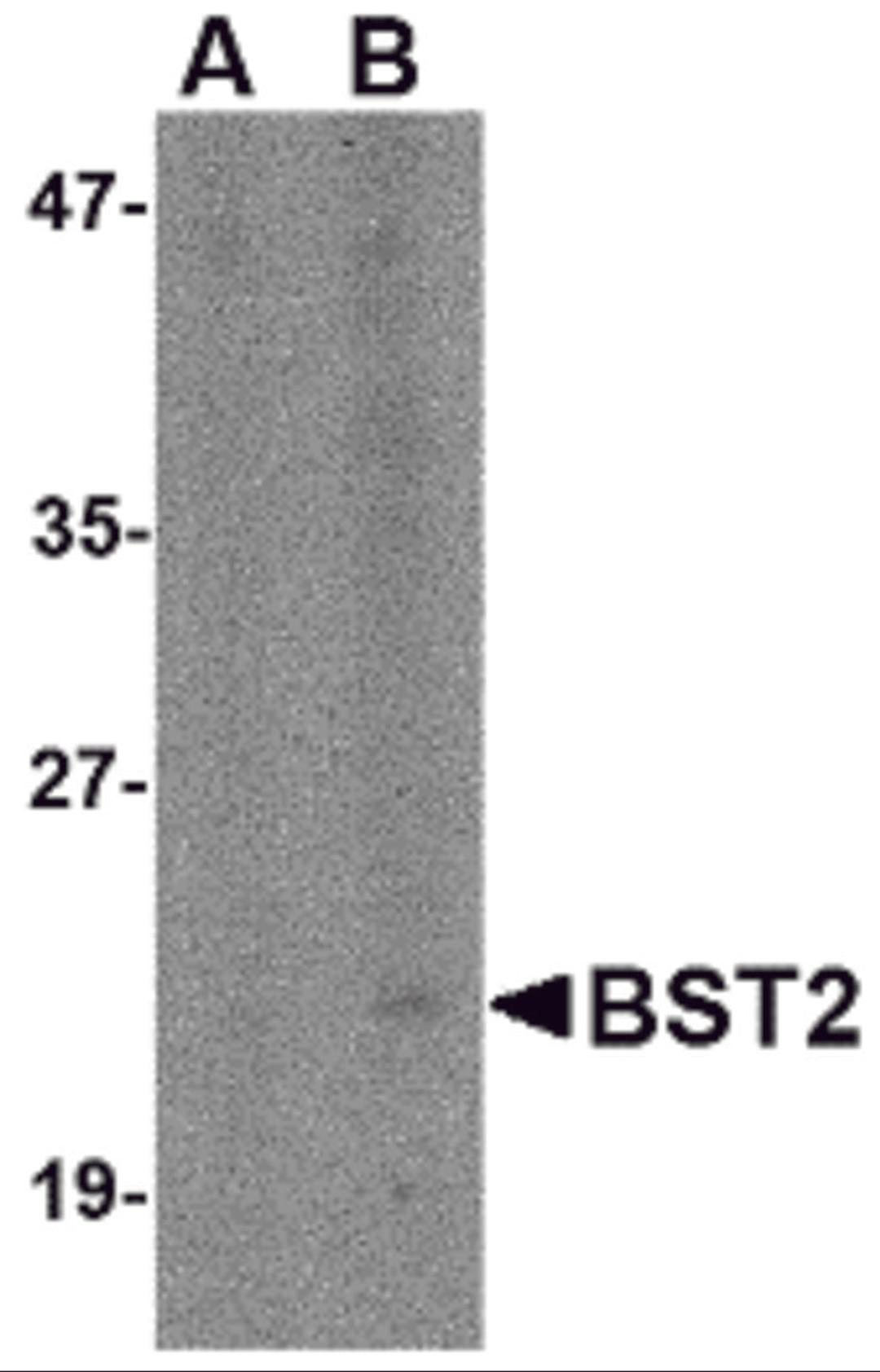 Western blot analysis of Bst2 in Daudi cell lysate with Bst2 antibody at (A) 1 and (B) 2 μg/mL.