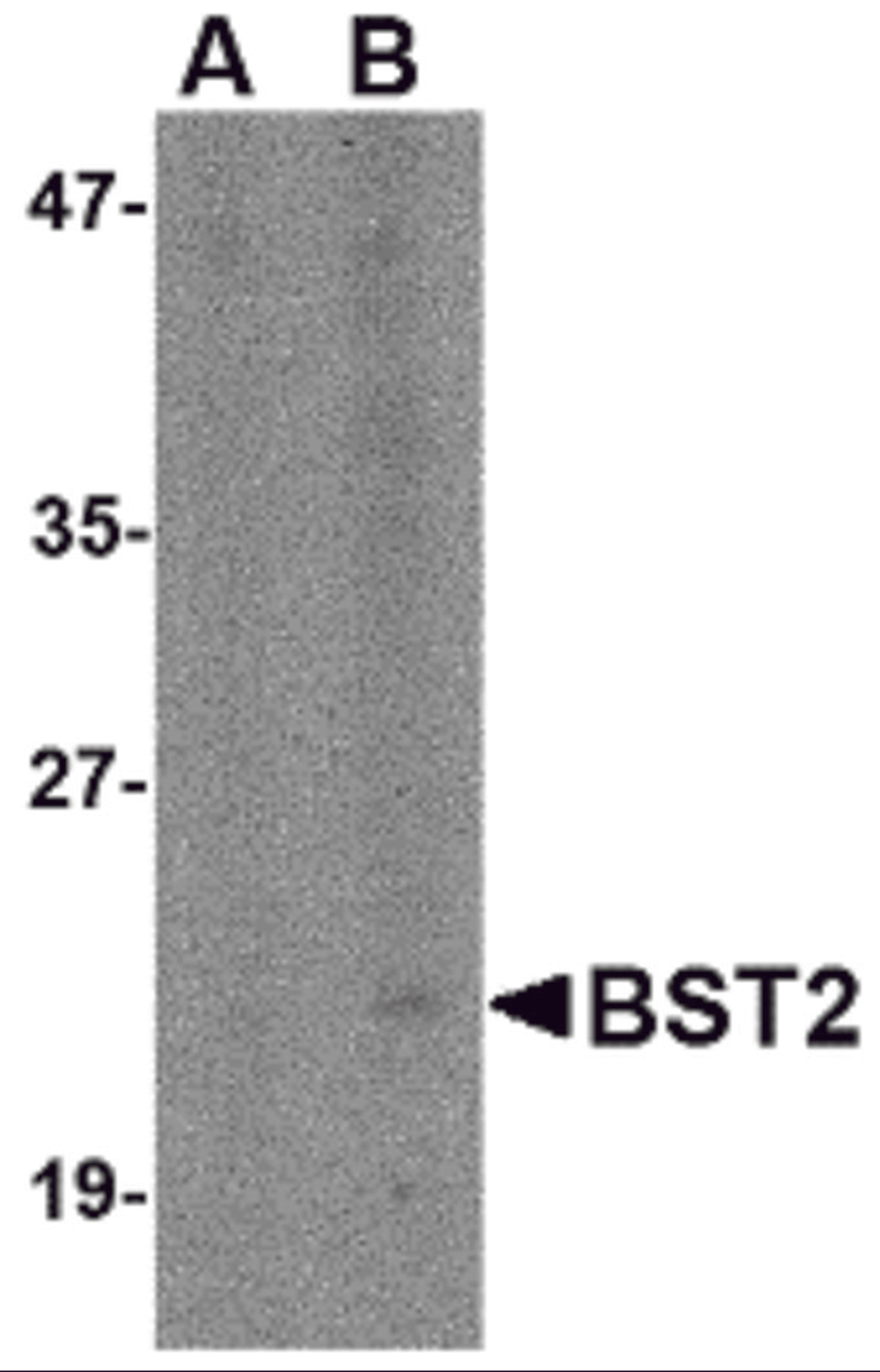Western blot analysis of Bst2 in Daudi cell lysate with Bst2 antibody at (A) 1 and (B) 2 μg/mL.