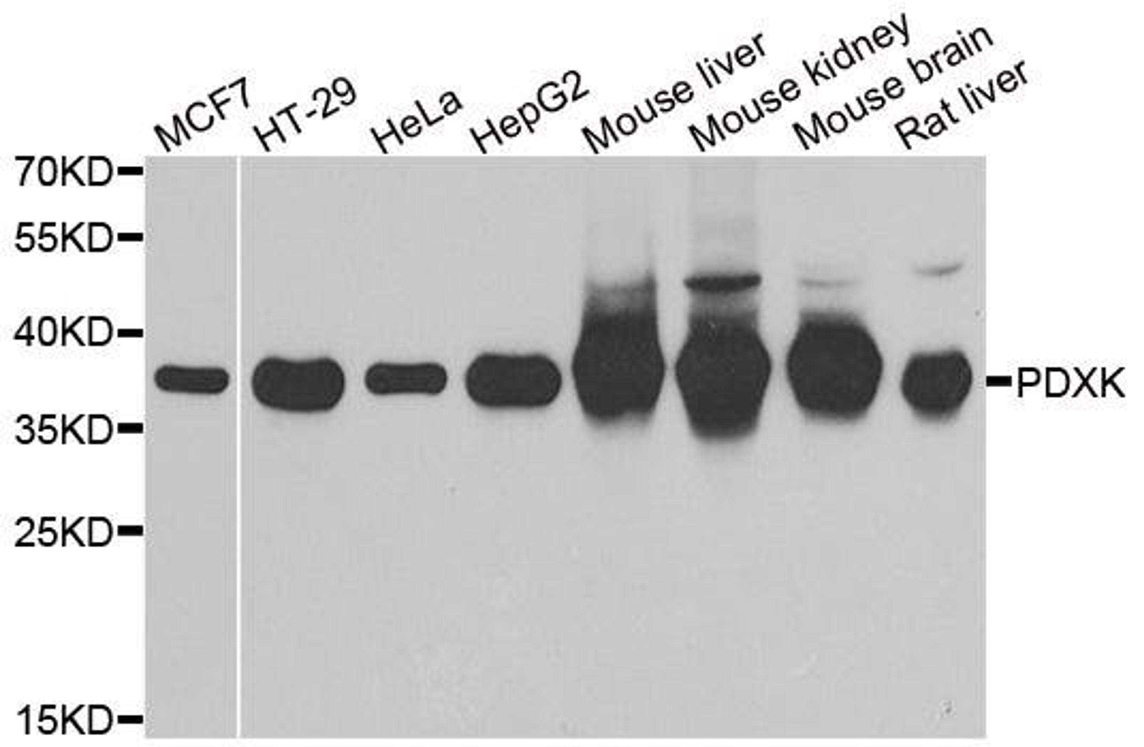 Western blot analysis of extracts of various cell lines using PDXK antibody