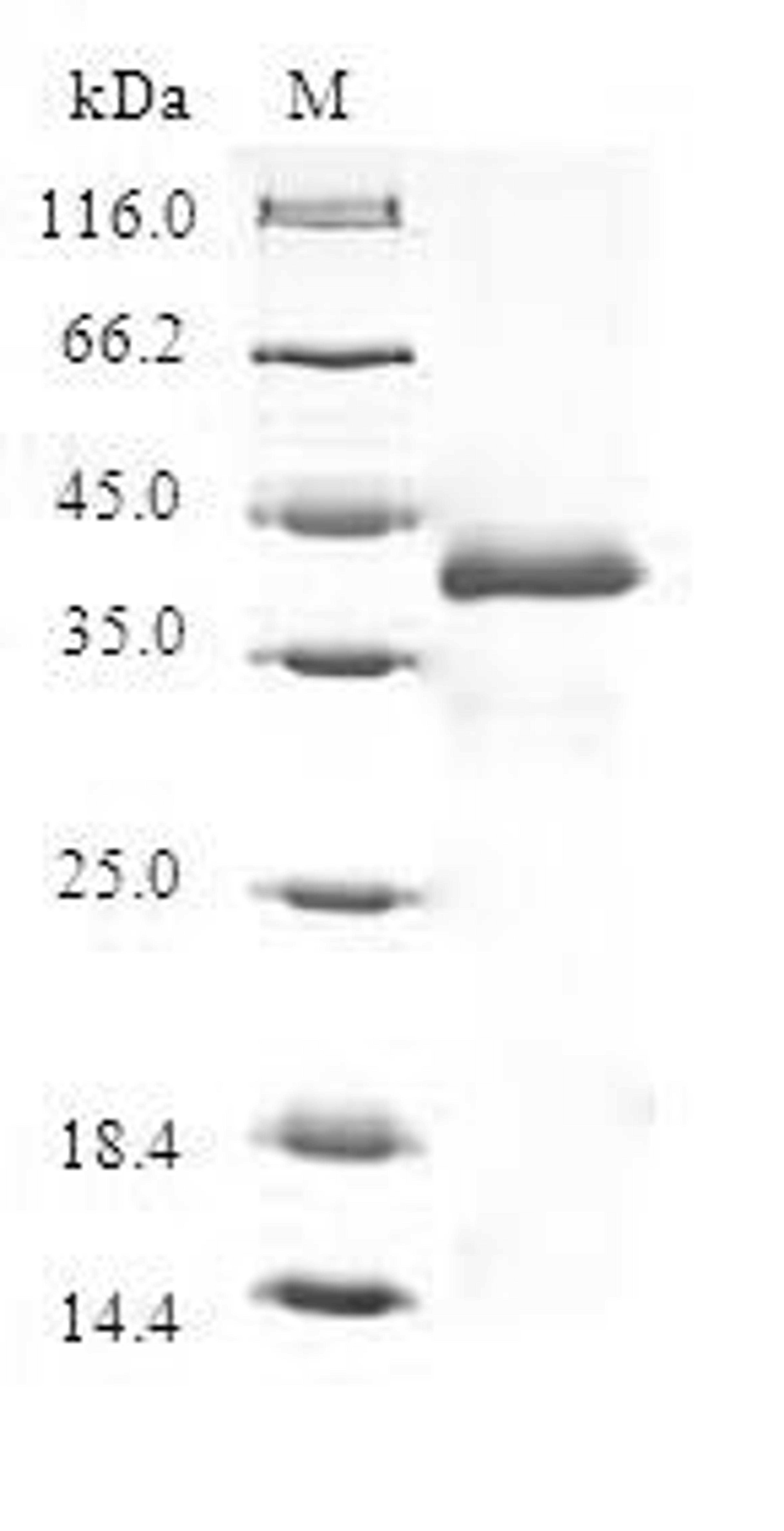 (Tris-Glycine gel) Discontinuous SDS-PAGE (reduced) with 5% enrichment gel and 15% separation gel.