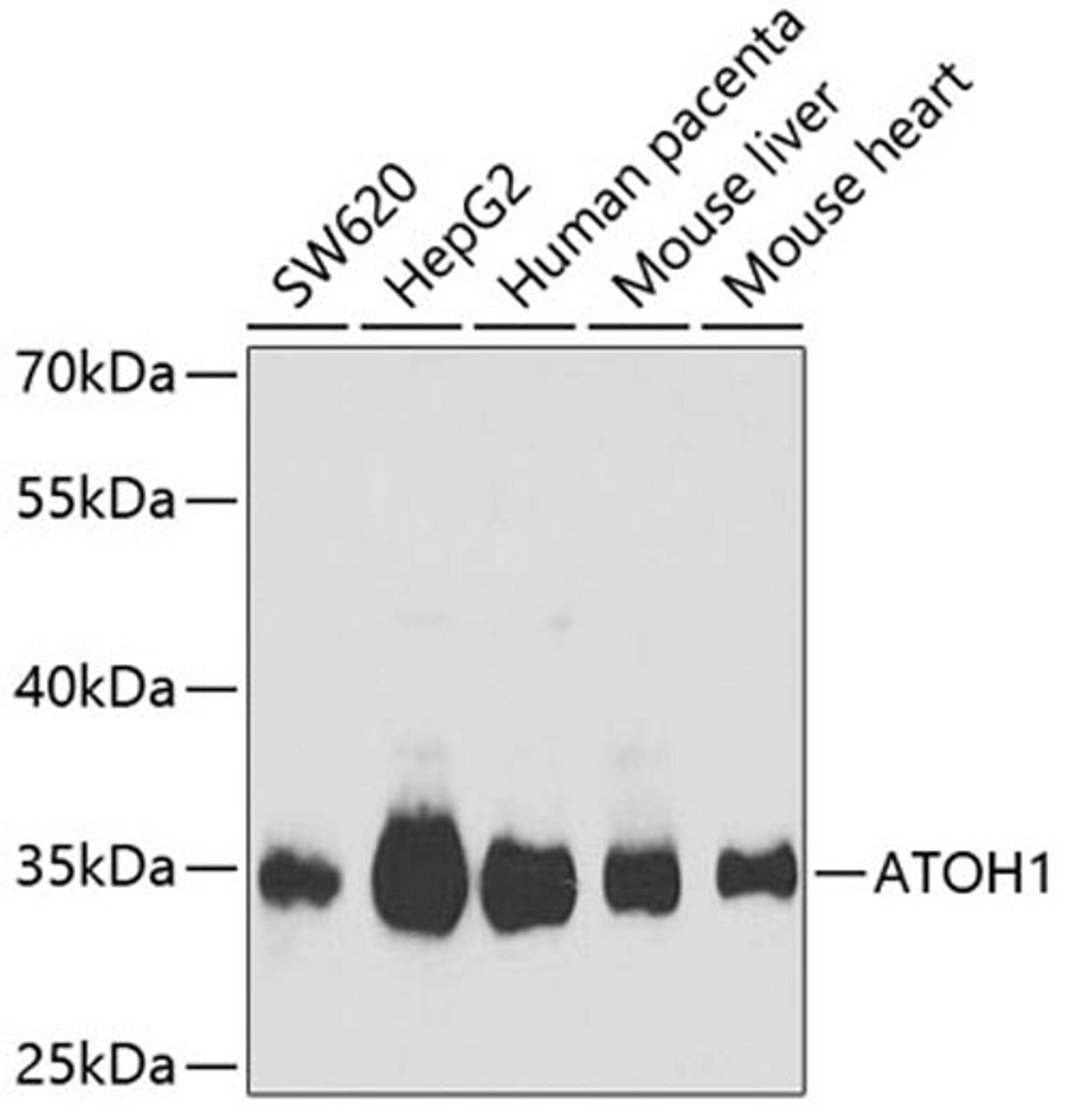 Western blot - ATOH1 Antibody (A6530)