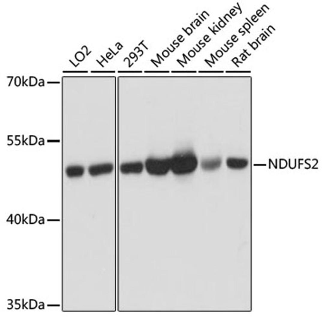 Western blot - NDUFS2 antibody (A12858)