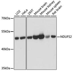 Western blot - NDUFS2 antibody (A12858)