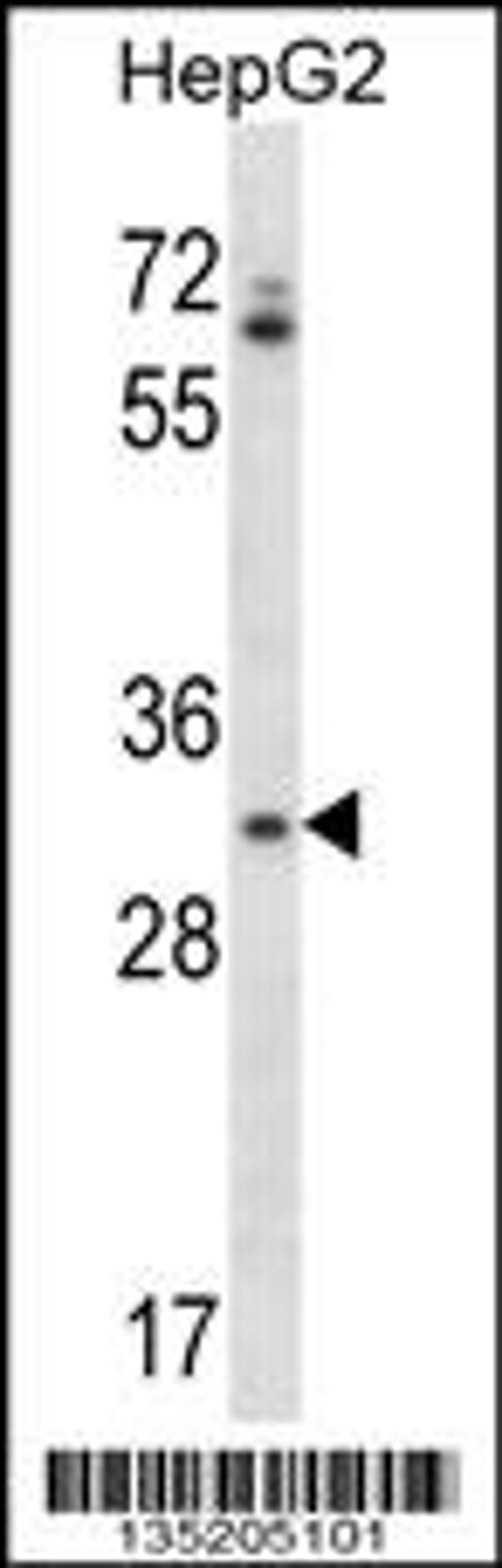 Western blot analysis in HepG2 cell line lysates (35ug/lane).