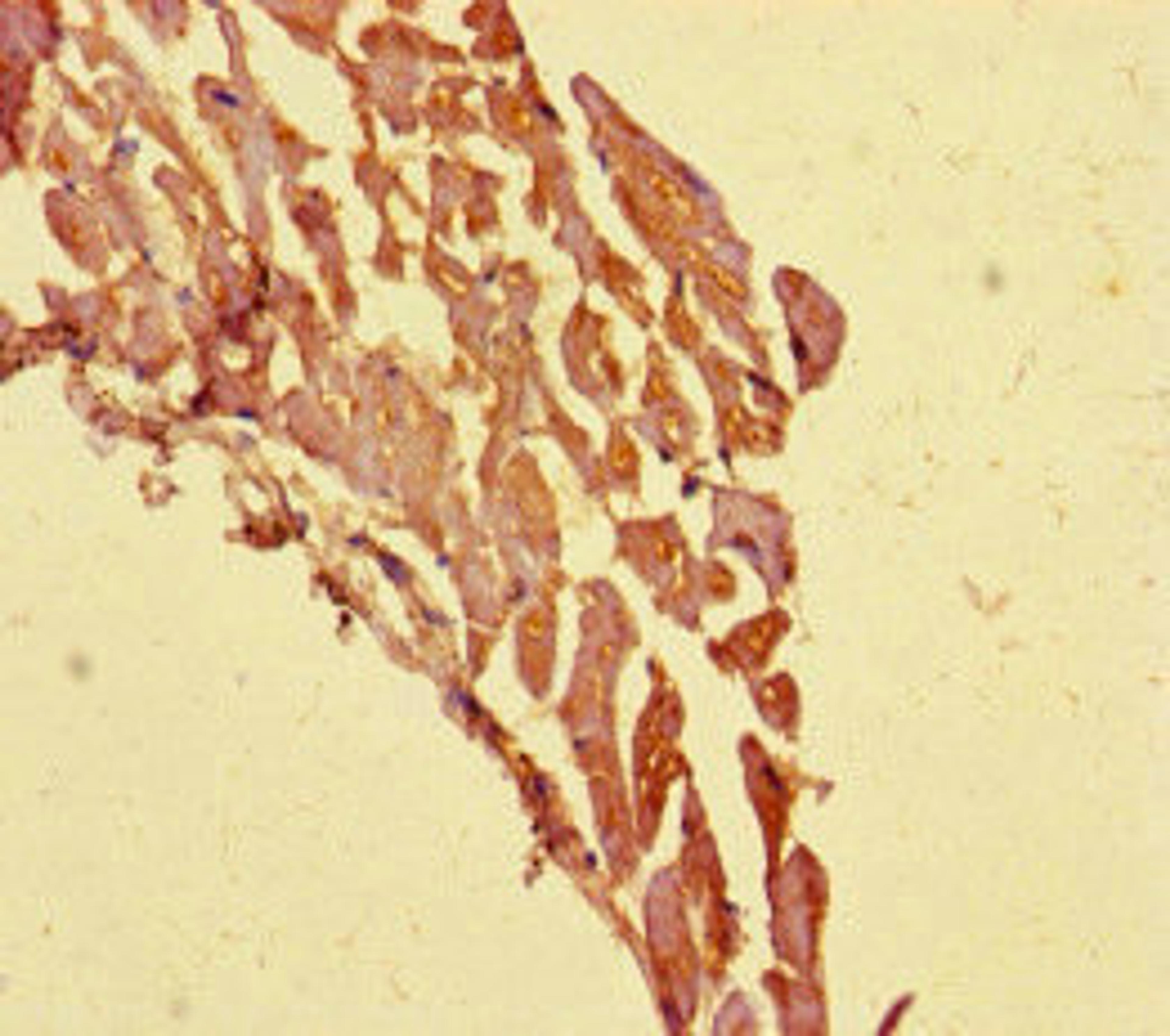 Immunohistochemistry of paraffin-embedded human heart tissue using CSB-PA773603LA01HU at dilution of 1:100
