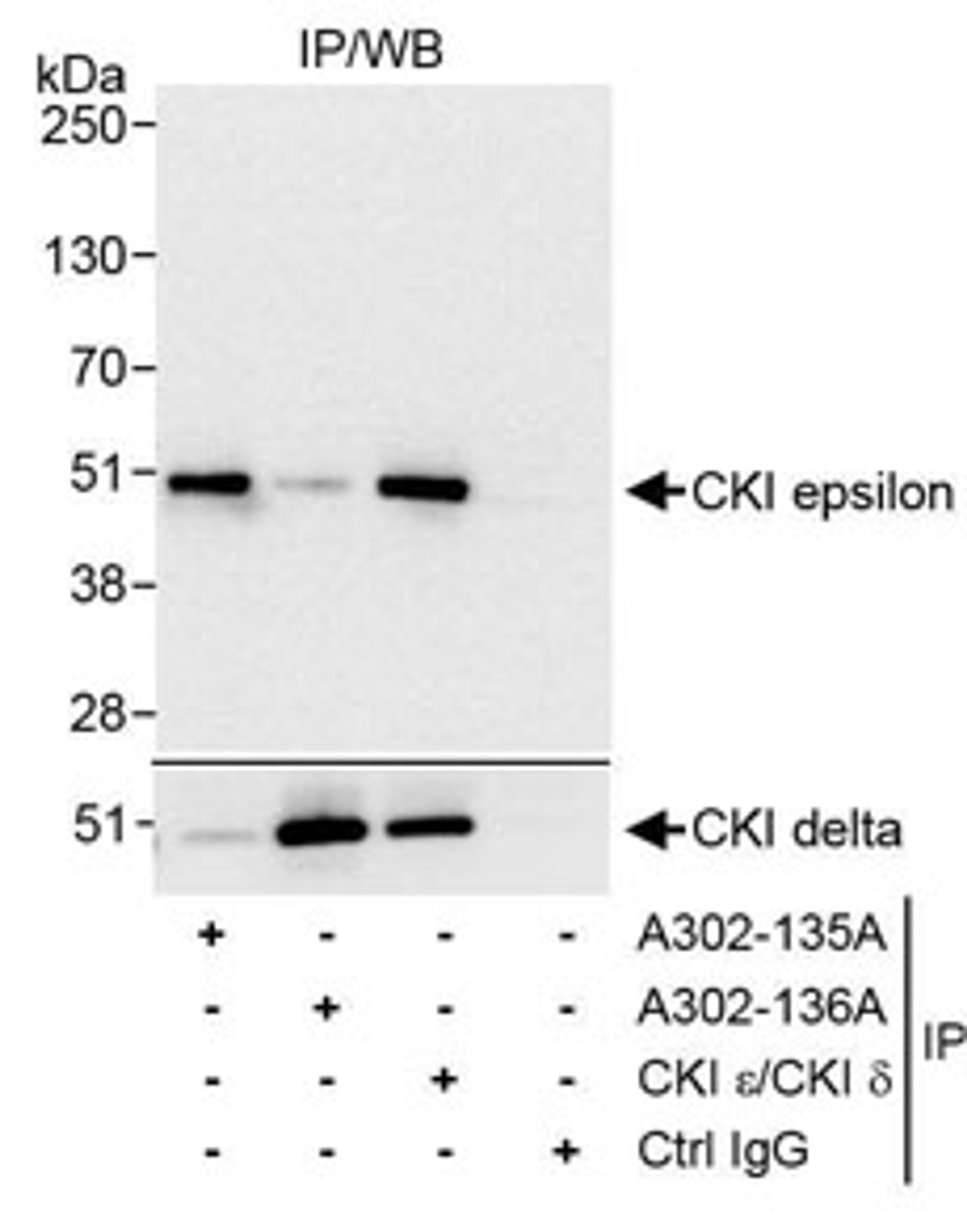 Detection of human CKI epsilon by western blot of immunoprecipitates.