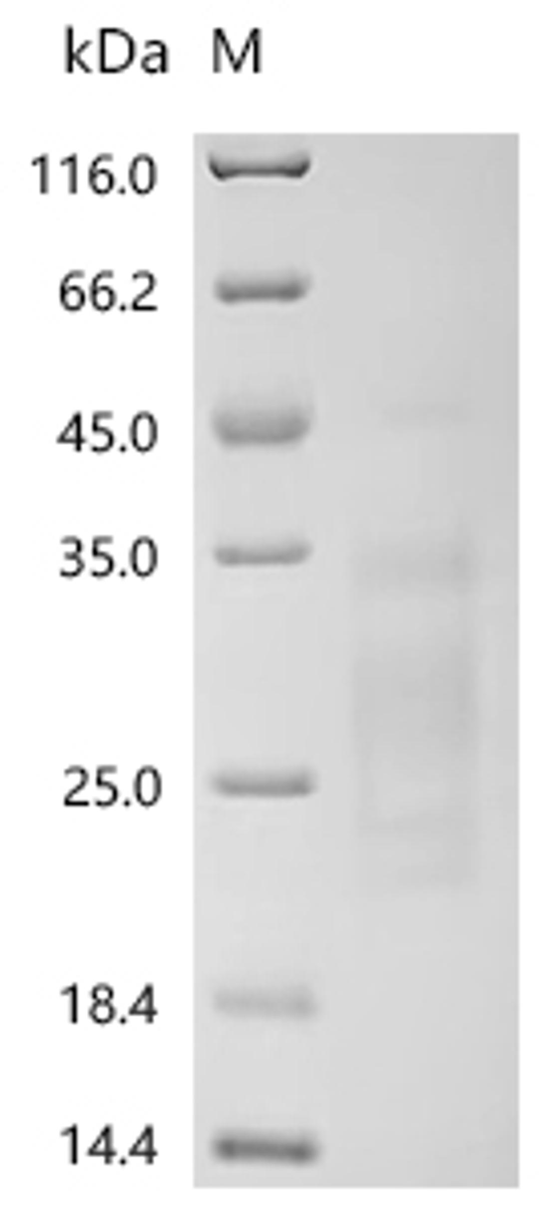 (Tris-Glycine gel) Discontinuous SDS-PAGE (reduced) with 5% enrichment gel and 15% separation gel.