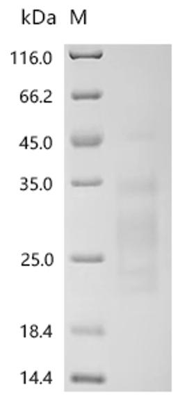 (Tris-Glycine gel) Discontinuous SDS-PAGE (reduced) with 5% enrichment gel and 15% separation gel.