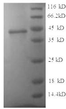 (Tris-Glycine gel) Discontinuous SDS-PAGE (reduced) with 5% enrichment gel and 15% separation gel.