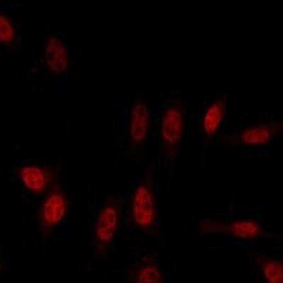 Immunocytochemistry/Immunofluorescence: Sars M Antibody (2H2C4) [NBP1-28852] - Immunofluorescence analysis of LOVO cells using AML1 Rabbit pAb (Red).