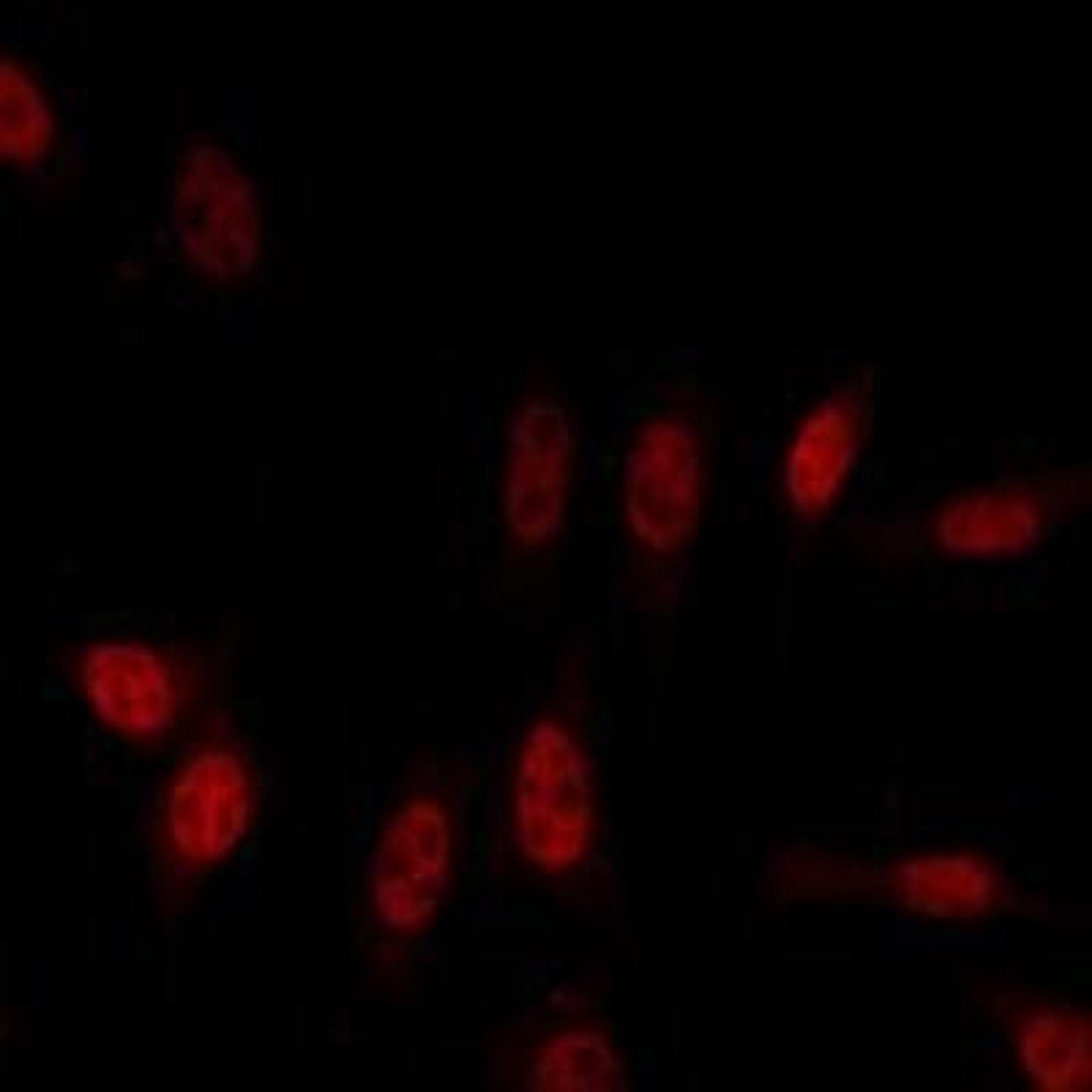 Immunocytochemistry/Immunofluorescence: Sars M Antibody (2H2C4) [NBP1-28852] - Immunofluorescence analysis of LOVO cells using AML1 Rabbit pAb (Red).