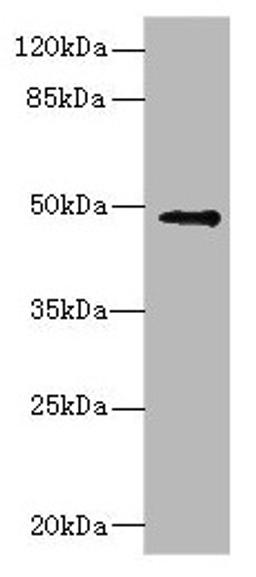 Western blot. All lanes: IP6K2 antibody at 3.12µg/ml + Raji whole cell lysate. Secondary. Goat polyclonal to rabbit IgG at 1/10000 dilution. Predicted band size: 50, 12, 9, 21, 22, 10 kDa. Observed band size: 50 kDa