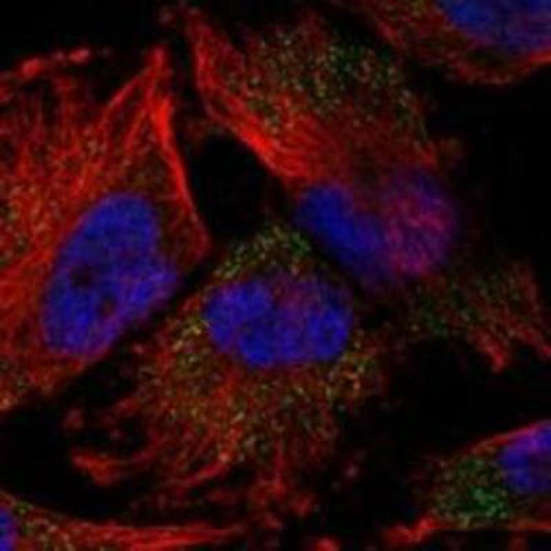 Immunocytochemistry/Immunofluorescence: PYK2 Antibody [NBP1-91228] - Staining of human cell line U-251 MG shows positivity in cytoplasm.