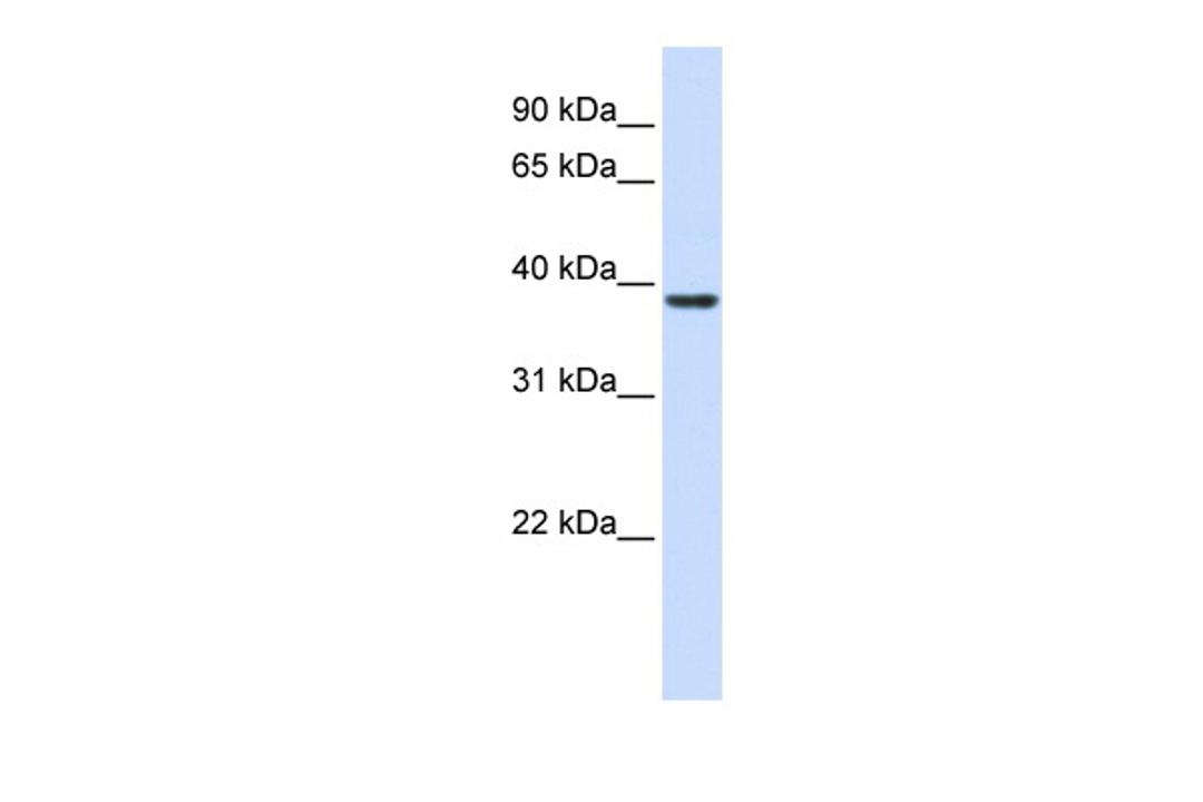 Antibody used in WB on Human Muscle at 0.2-1 ug/ml.