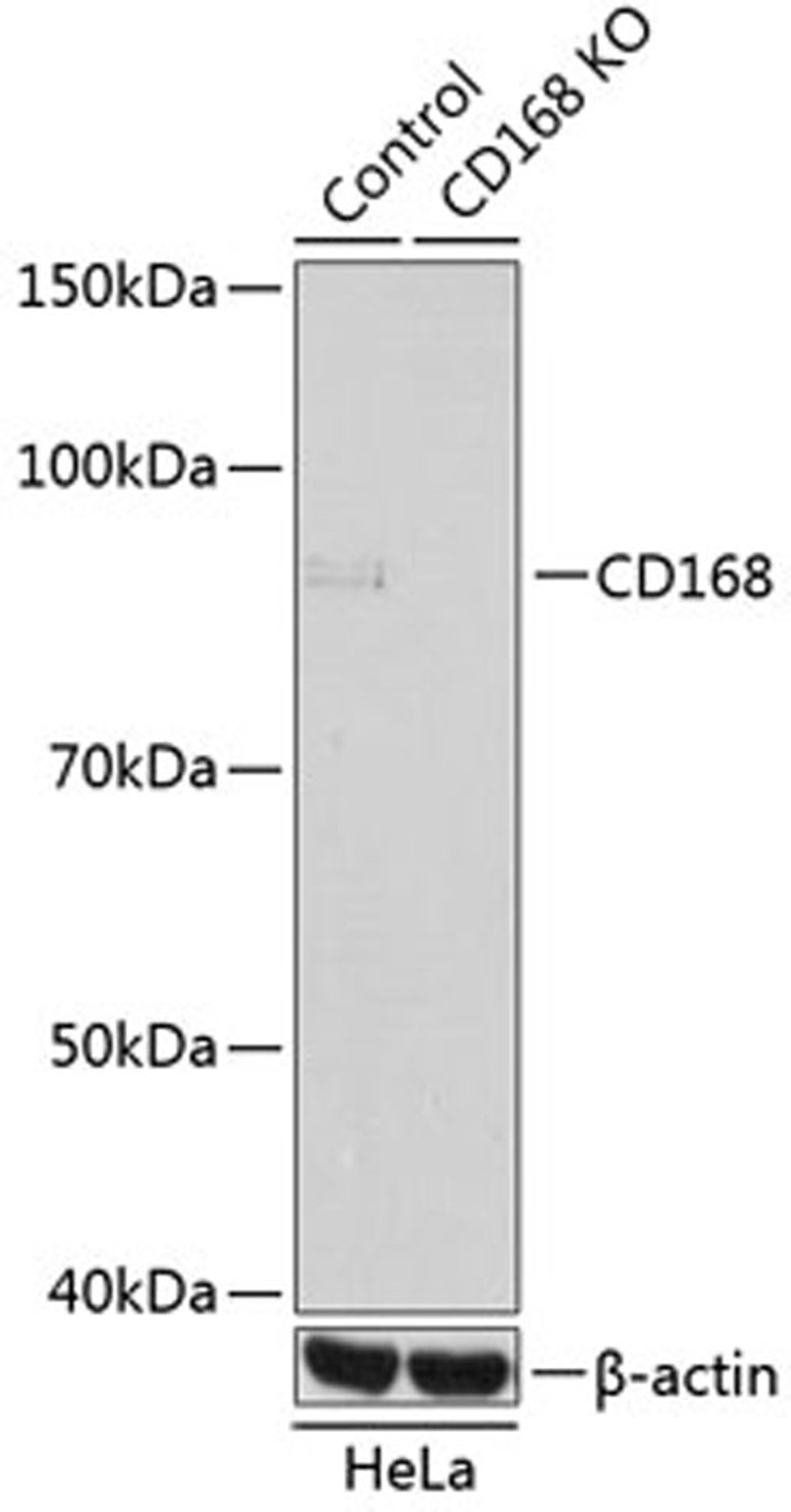 Western blot - CD168 Rabbit mAb (A11666)