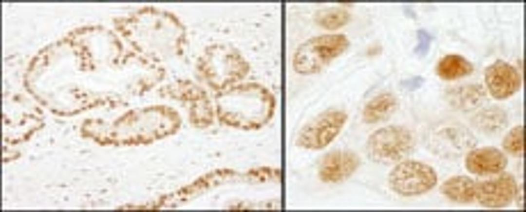 Detection of human SF3b155/SAP155 by immunohistochemistry.