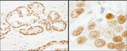 Detection of human SF3b155/SAP155 by immunohistochemistry.