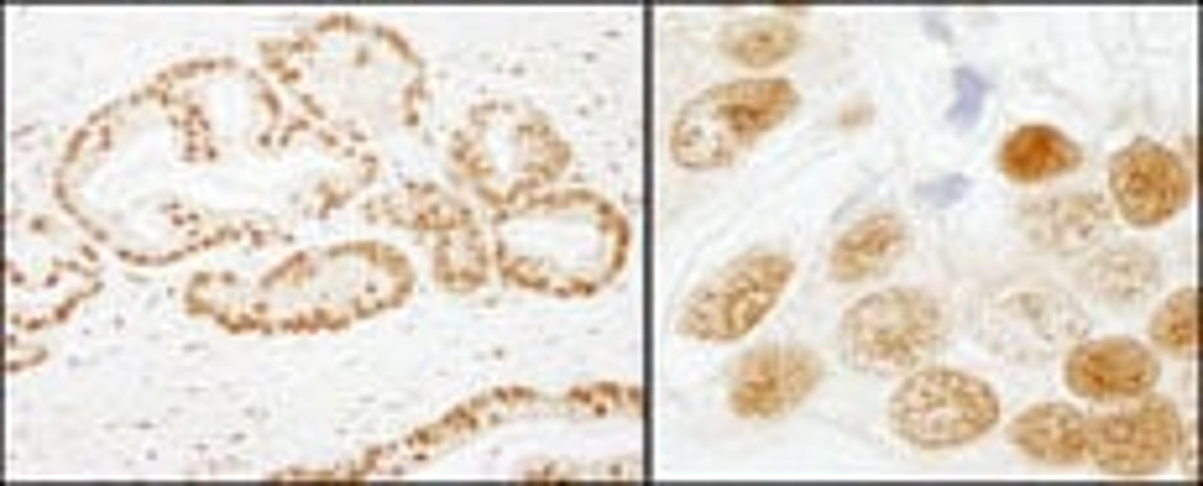 Detection of human SF3b155/SAP155 by immunohistochemistry.