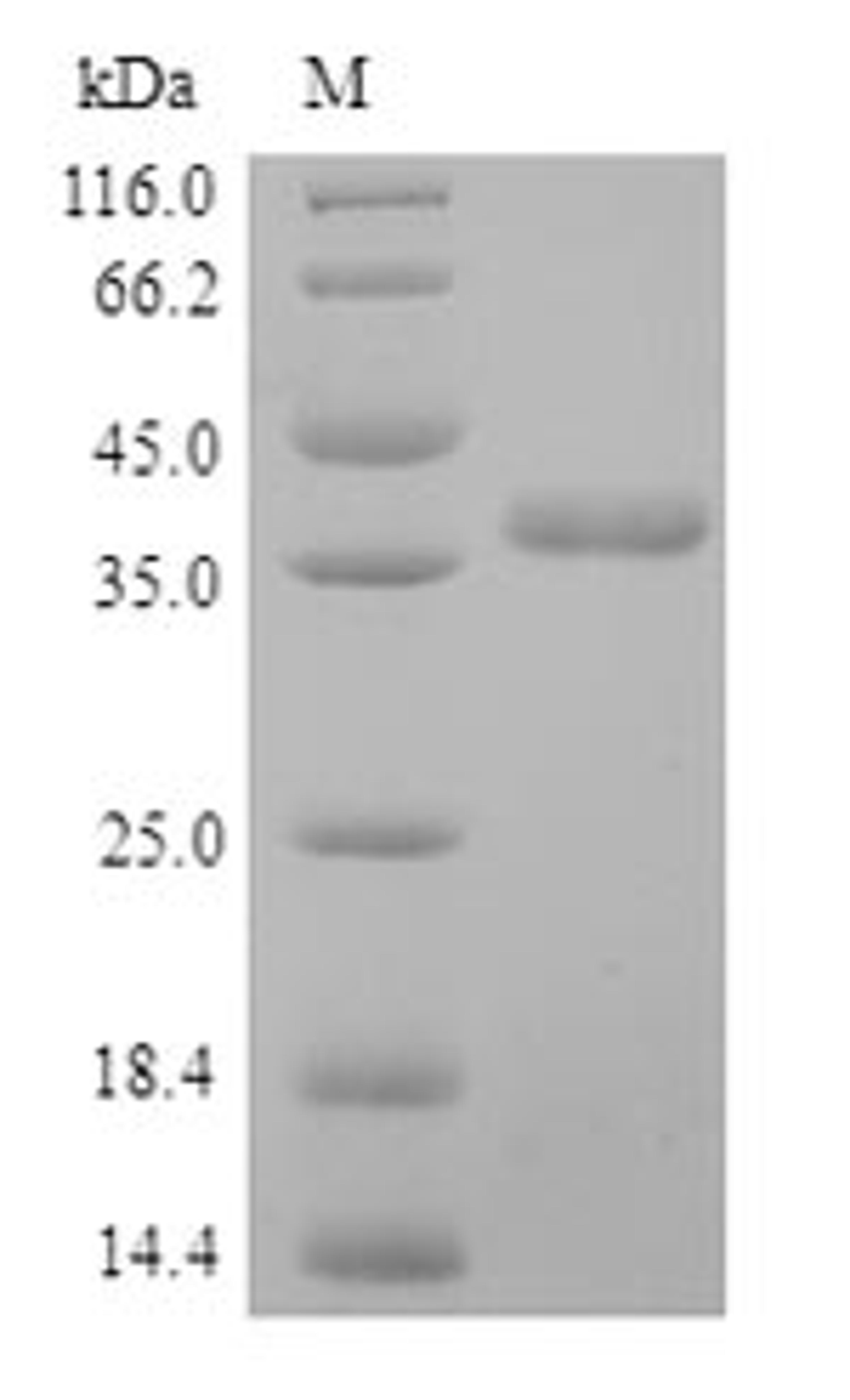 (Tris-Glycine gel) Discontinuous SDS-PAGE (reduced) with 5% enrichment gel and 15% separation gel.