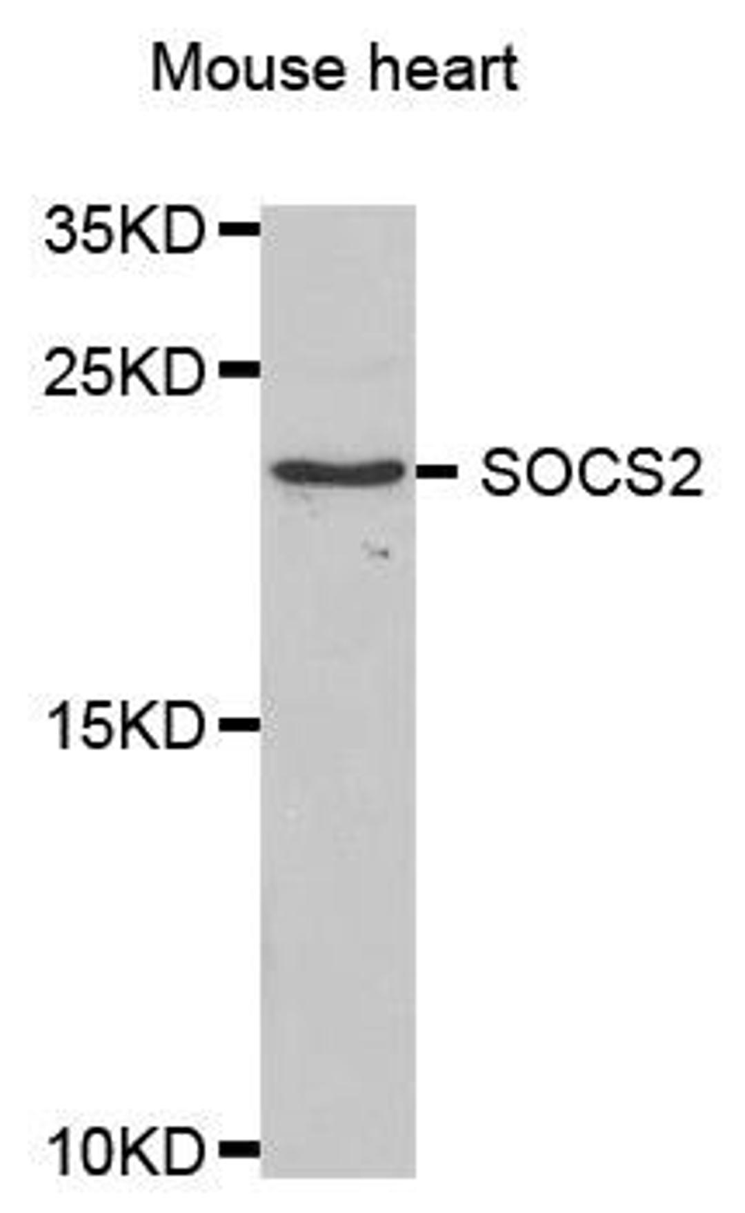 Western blot analysis of extracts of mouse heart using SOCS2 antibody