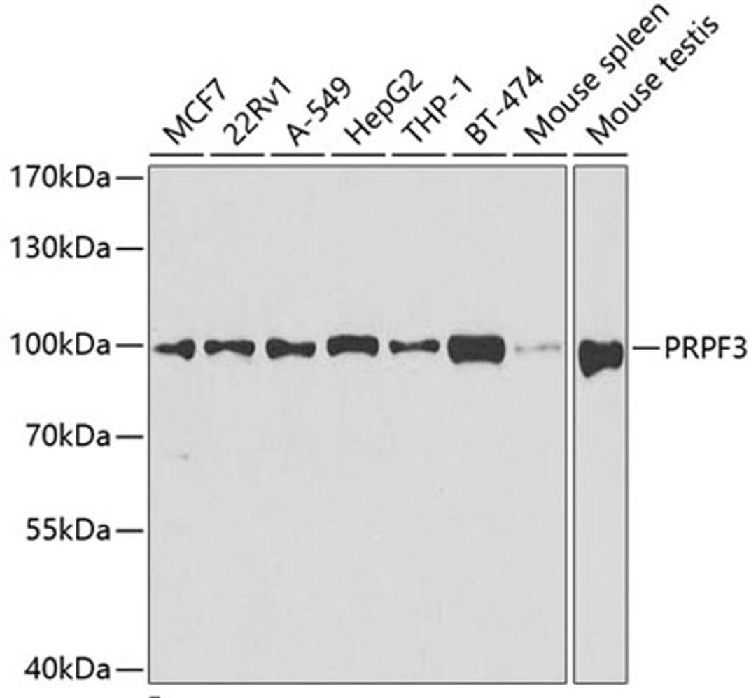 Western blot - PRPF3 antibody (A5482)