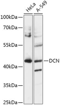 Western blot - Decorin antibody (A15048)