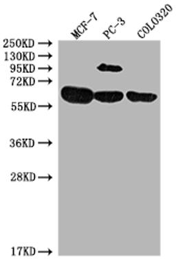 Western Blot. Positive WB detected in: MCF-7 whole cell lysate, PC-3 whole cell lysate, COLO320 whole cell lysate. All lanes: SRC antibody at 1:2000. Secondary. Goat polyclonal to rabbit IgG at 1/50000 dilution. Predicted band size: 60, 61 kDa. Observed band size: 60 kDa. 
