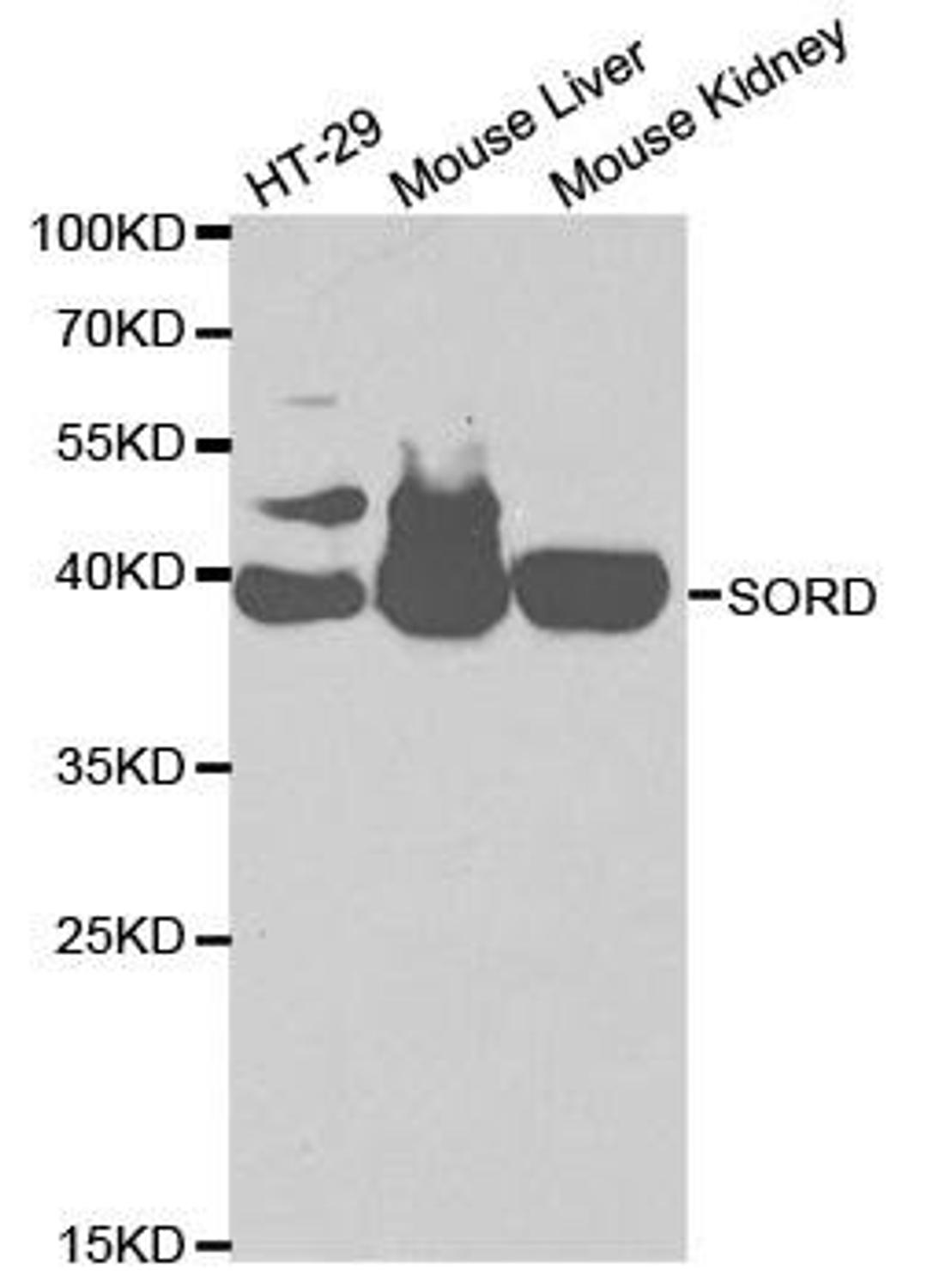 Western blot analysis of extracts of various cell lines using SORD antibody