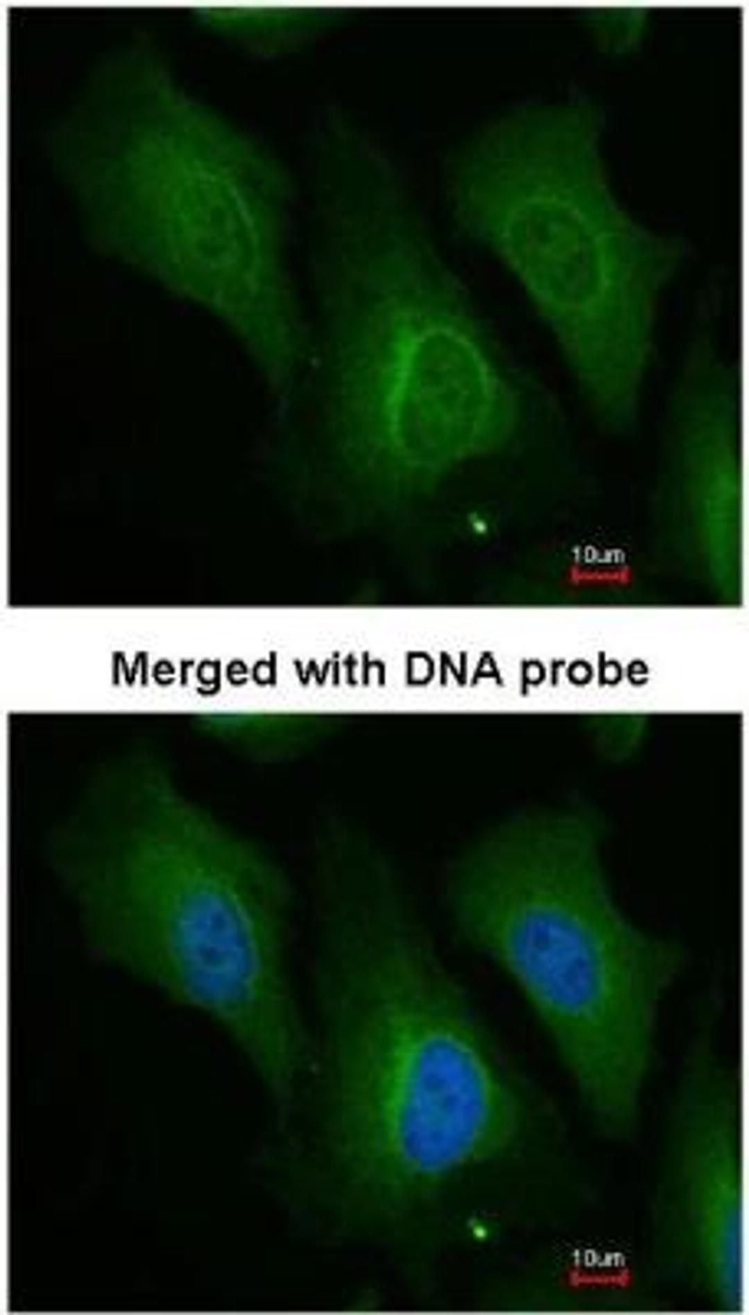 Immunocytochemistry: Dopamine beta-Hydroxylase Antibody [NBP1-31386] - Analysis of HeLa, using NBP1-31386 at 1:200 dilution.