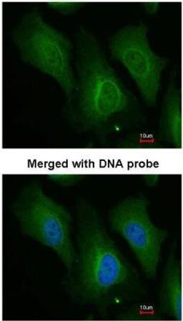 Immunocytochemistry: Dopamine beta-Hydroxylase Antibody [NBP1-31386] - Analysis of HeLa, using NBP1-31386 at 1:200 dilution.