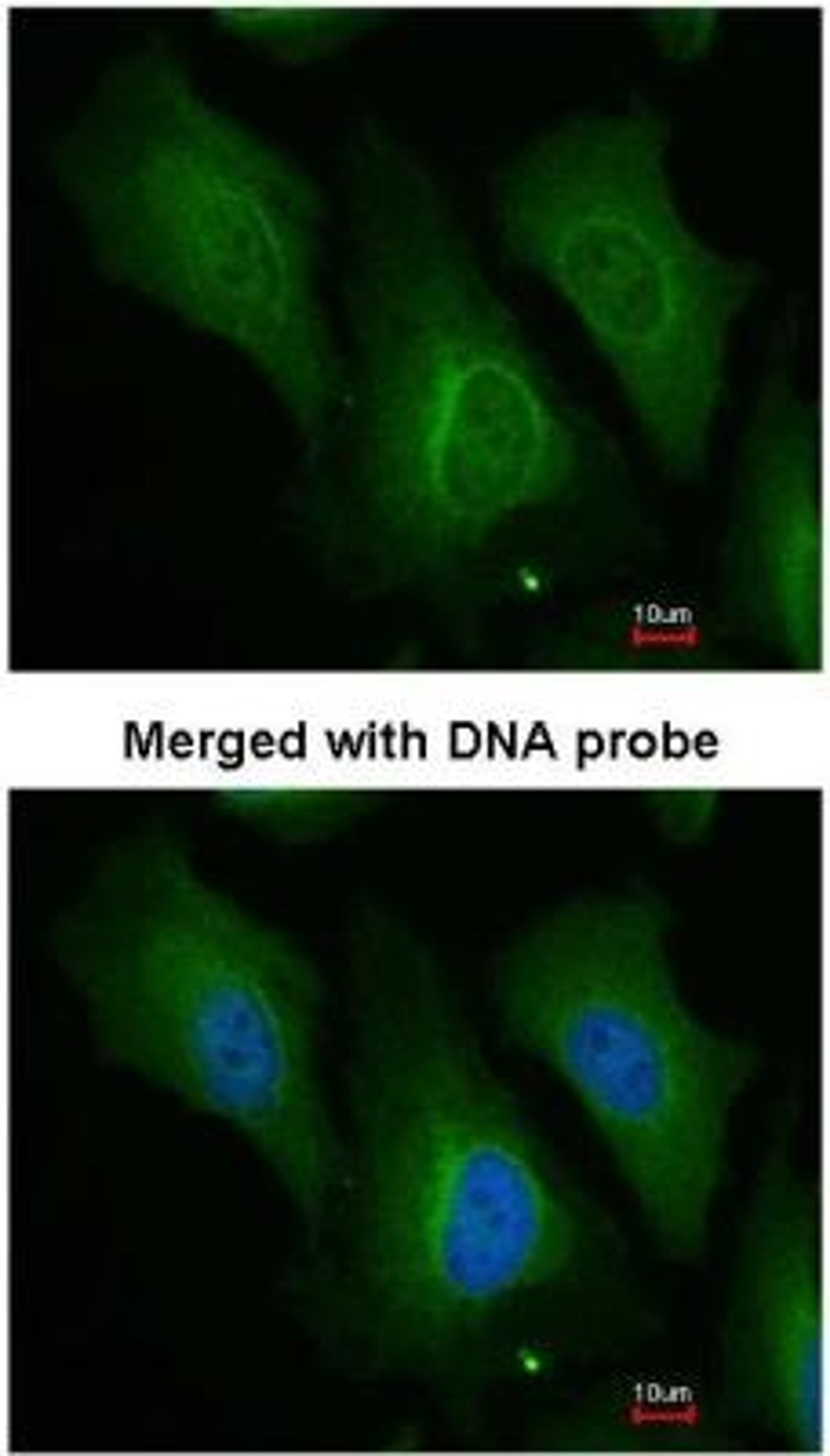 Immunocytochemistry: Dopamine beta-Hydroxylase Antibody [NBP1-31386] - Analysis of HeLa, using NBP1-31386 at 1:200 dilution.