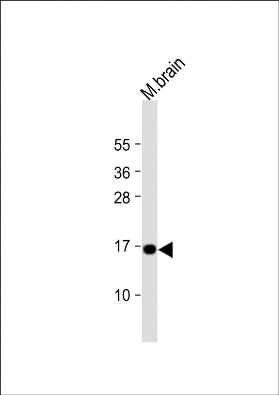 Western Blot at 1:1000 dilution + mouse brain lysate Lysates/proteins at 20 ug per lane.