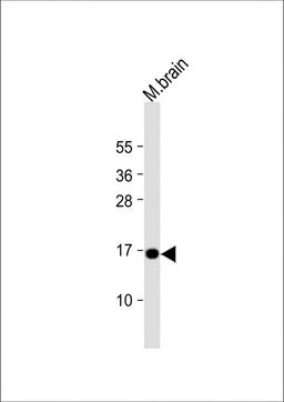 Western Blot at 1:1000 dilution + mouse brain lysate Lysates/proteins at 20 ug per lane.