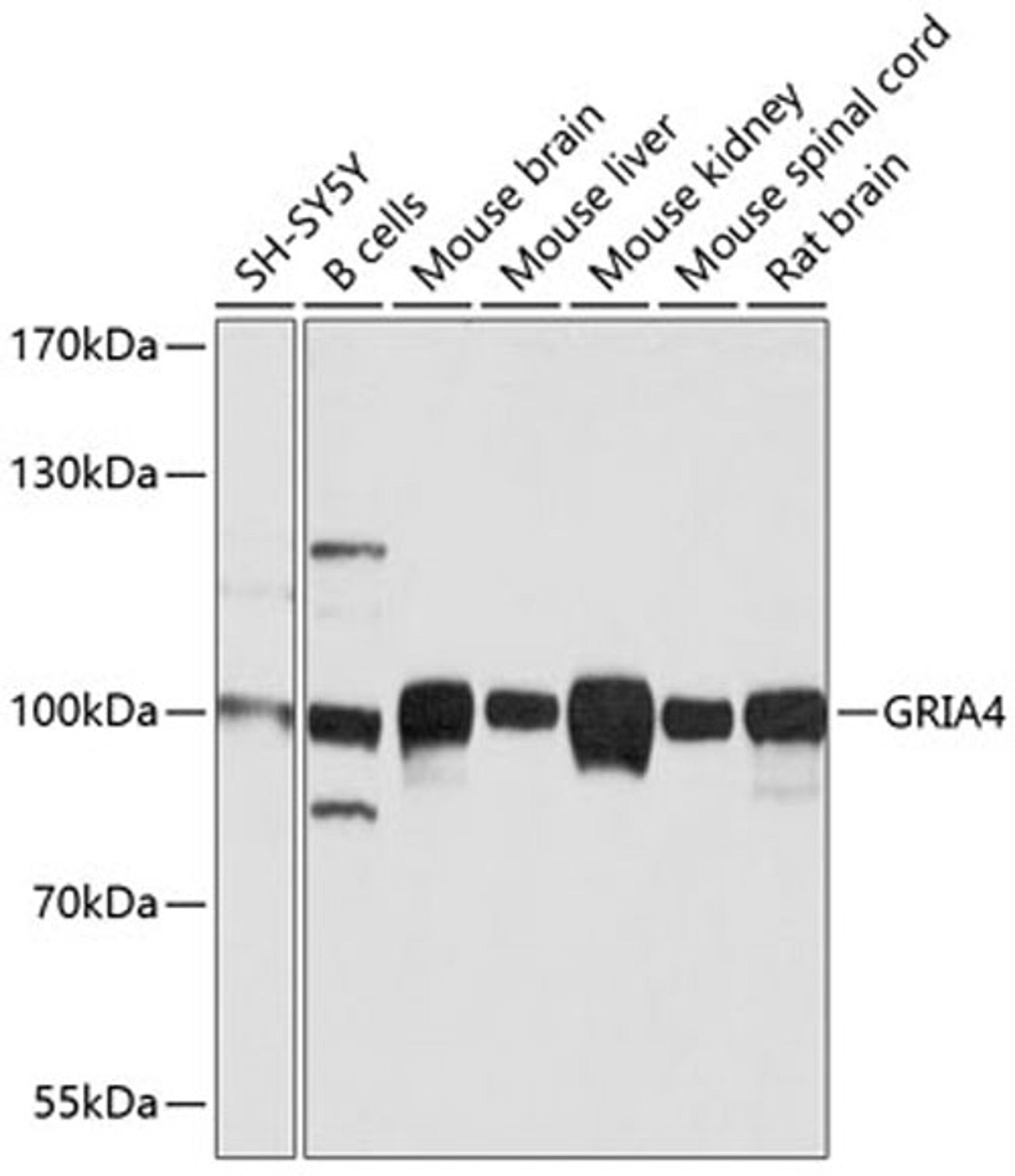 Western blot - GRIA4 antibody (A1492)